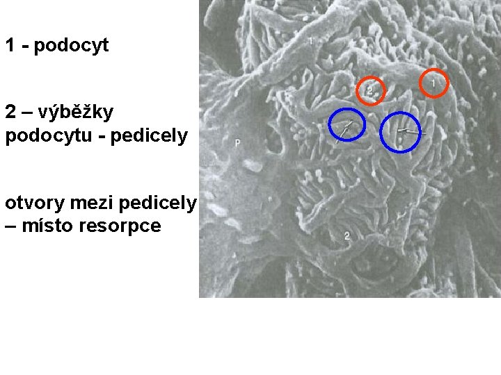 1 - podocyt 2 – výběžky podocytu - pedicely otvory mezi pedicely – místo