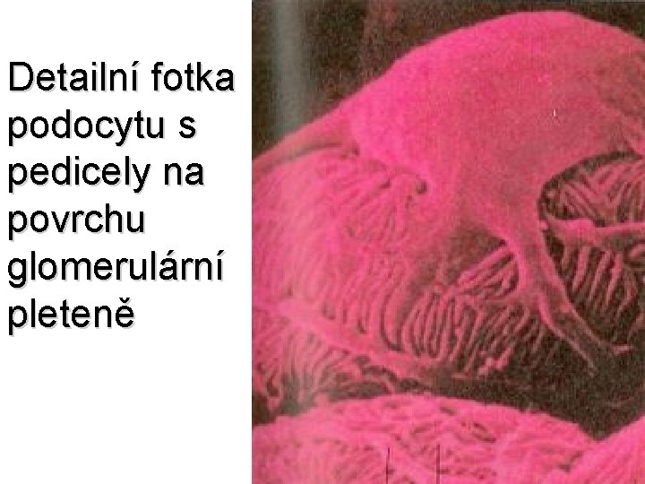 Detailní fotka podocytu s pedicely na povrchu glomerulární pleteně 