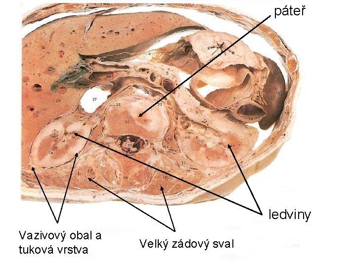 páteř ledviny Vazivový obal a tuková vrstva Velký zádový sval 