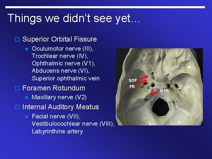 Things we didn’t see yet… o Superior Orbital Fissure n Oculumotor nerve (III), Trochlear