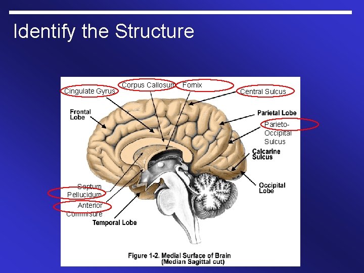Identify the Structure Cingulate Gyrus Corpus Callosum Fornix Central Sulcus Parieto. Occipital Sulcus Septum