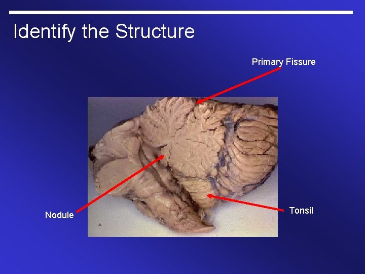Identify the Structure Primary Fissure Nodule Tonsil 