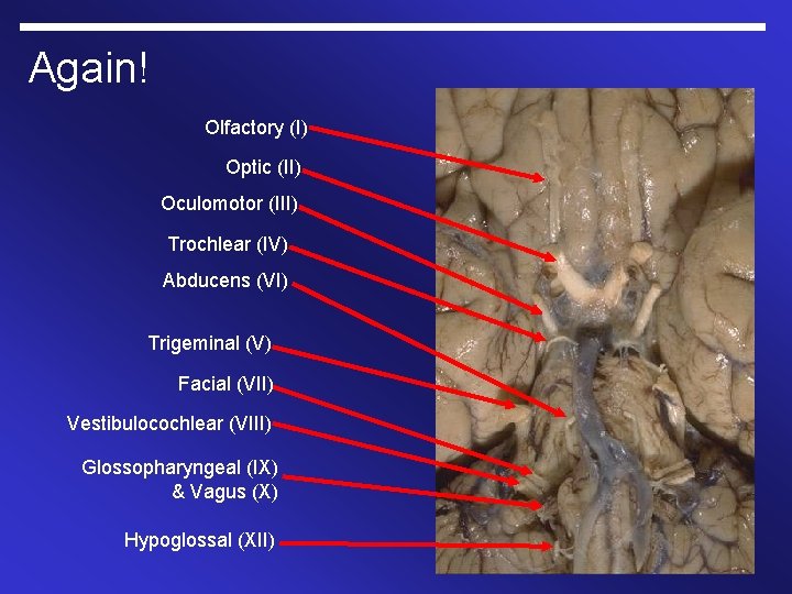 Again! Olfactory (I) Optic (II) Oculomotor (III) Trochlear (IV) Abducens (VI) Trigeminal (V) Facial