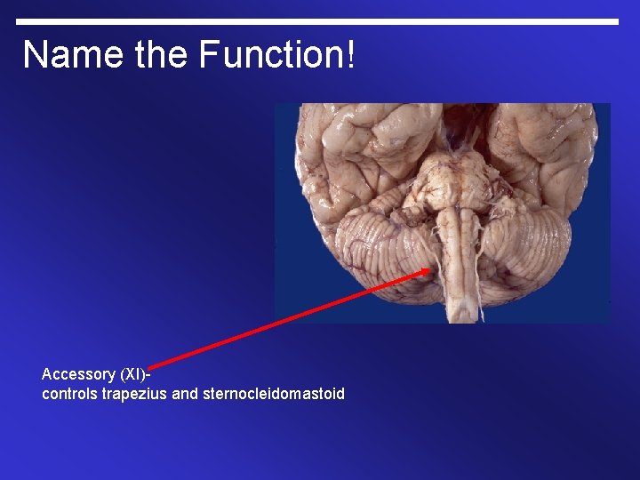 Name the Function! Accessory (XI)controls trapezius and sternocleidomastoid 