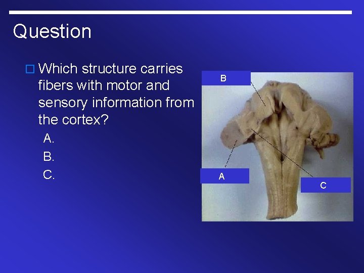 Question o Which structure carries fibers with motor and sensory information from the cortex?