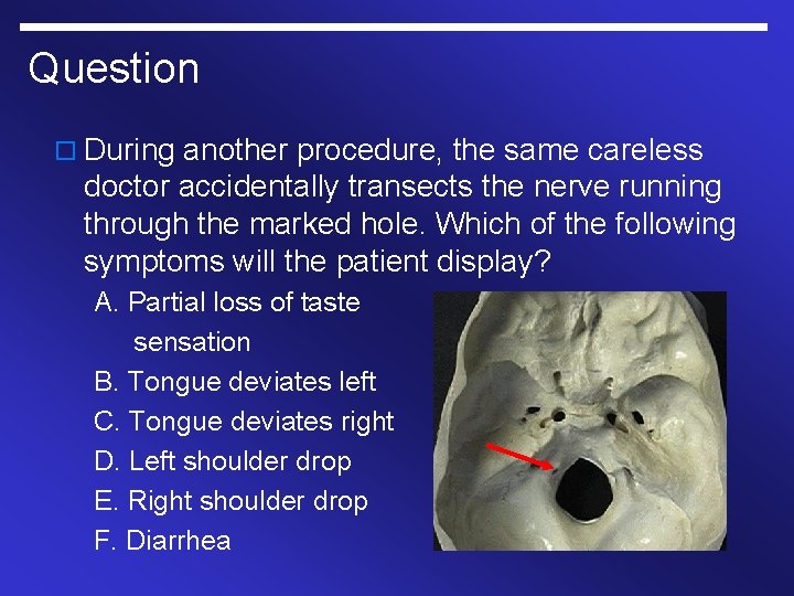 Question o During another procedure, the same careless doctor accidentally transects the nerve running