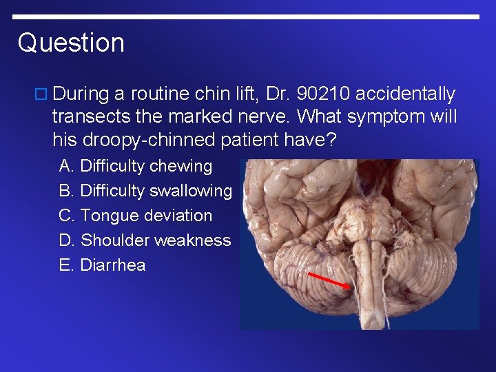 Question o During a routine chin lift, Dr. 90210 accidentally transects the marked nerve.