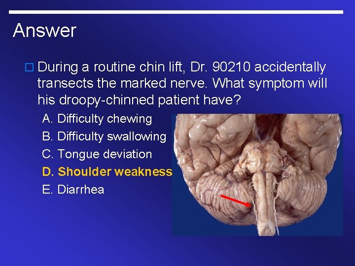 Answer o During a routine chin lift, Dr. 90210 accidentally transects the marked nerve.