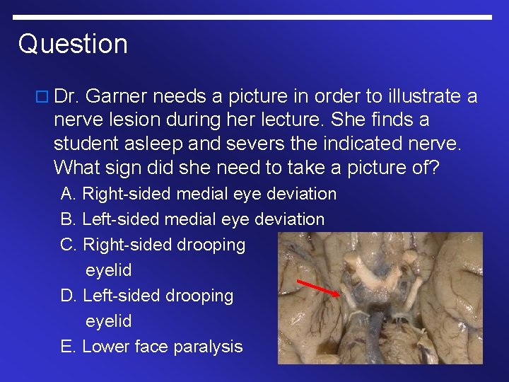 Question o Dr. Garner needs a picture in order to illustrate a nerve lesion