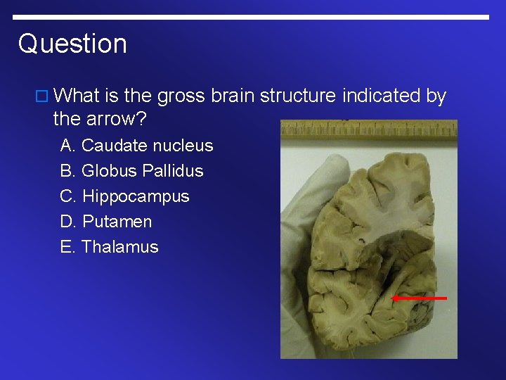 Question o What is the gross brain structure indicated by the arrow? A. Caudate