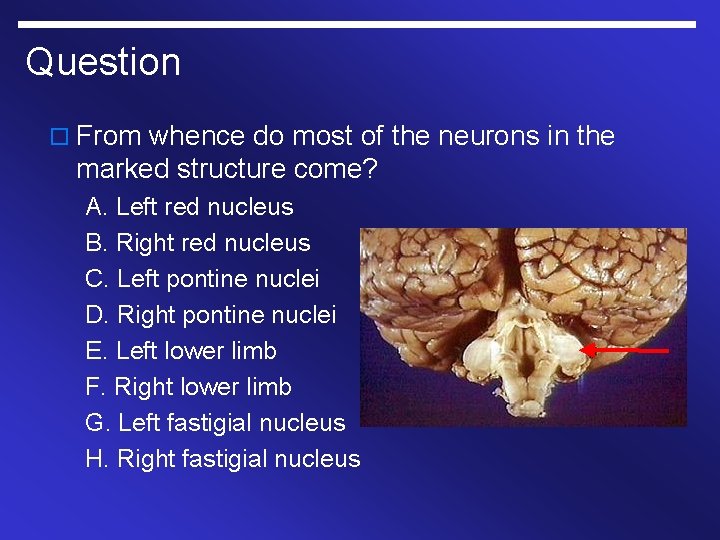 Question o From whence do most of the neurons in the marked structure come?