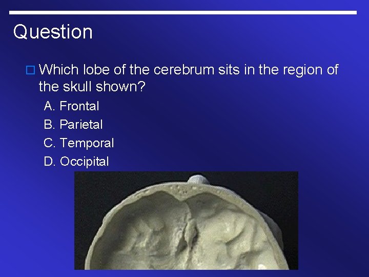 Question o Which lobe of the cerebrum sits in the region of the skull