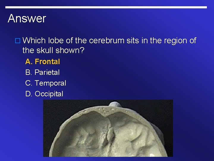 Answer o Which lobe of the cerebrum sits in the region of the skull