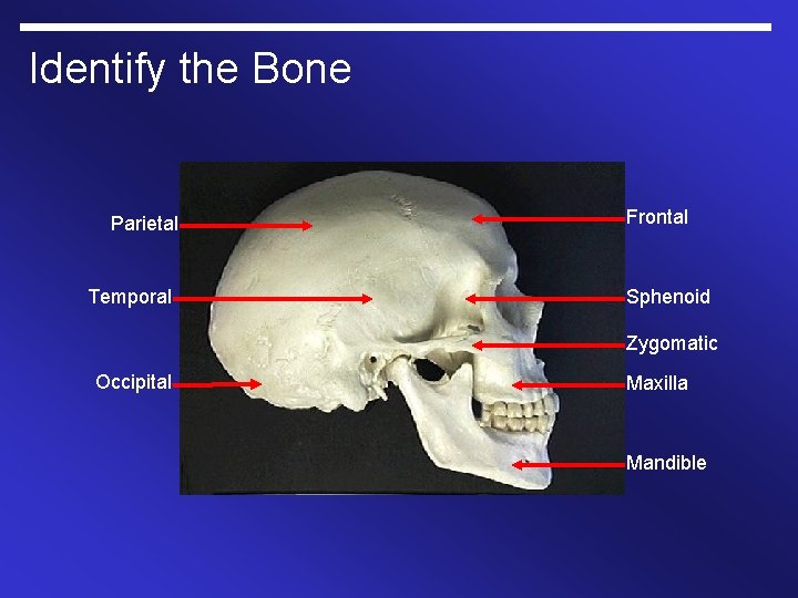 Identify the Bone Parietal Temporal Frontal Sphenoid Zygomatic Occipital Maxilla Mandible 