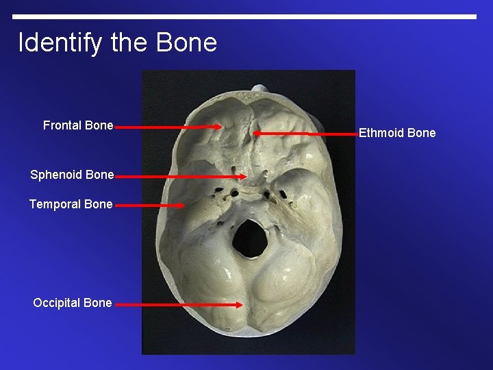 Identify the Bone Frontal Bone Sphenoid Bone Temporal Bone Occipital Bone Ethmoid Bone 