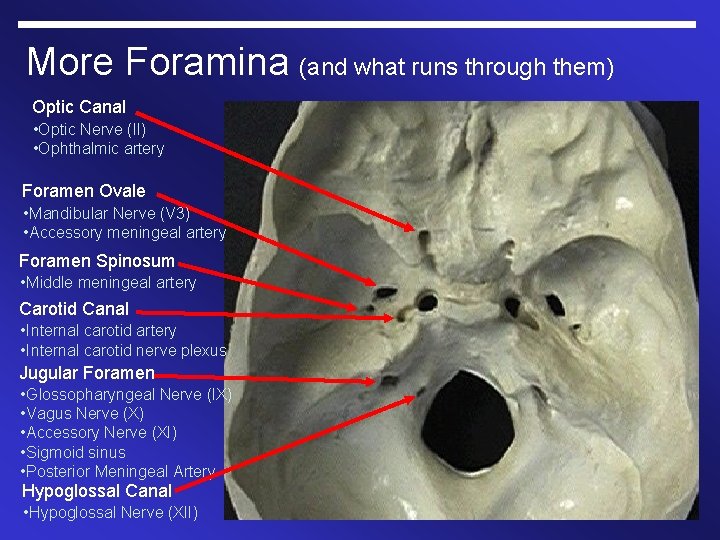 More Foramina (and what runs through them) Optic Canal • Optic Nerve (II) •