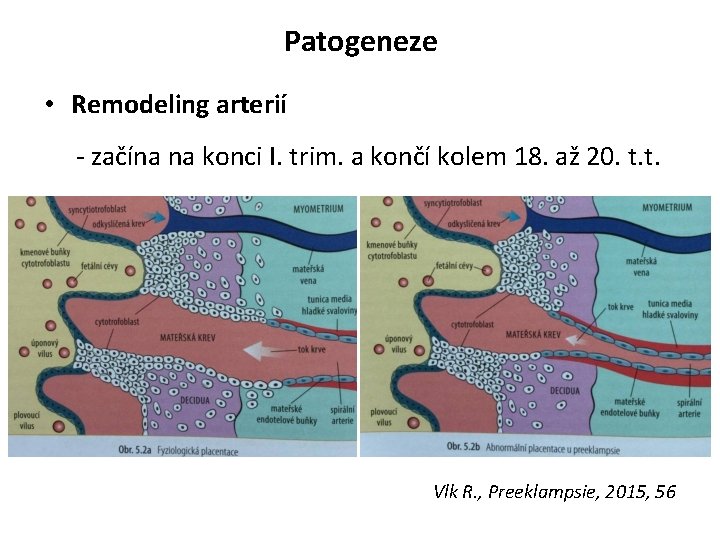 Patogeneze • Remodeling arterií - začína na konci I. trim. a končí kolem 18.