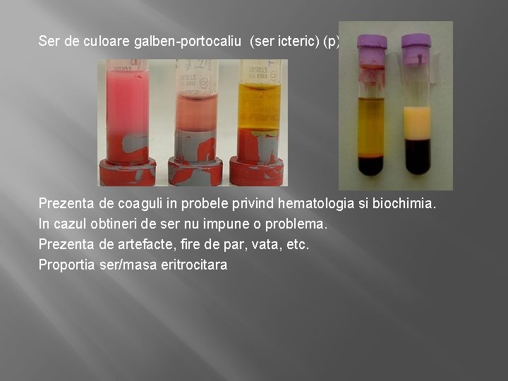 Ser de culoare galben-portocaliu (ser icteric) (p) Prezenta de coaguli in probele privind hematologia