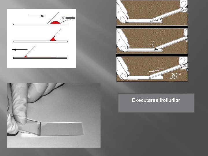 Executarea frotiurilor 