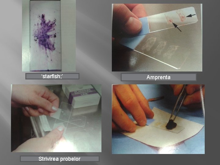 ‘starfish; ’ Strivirea probelor Amprenta 