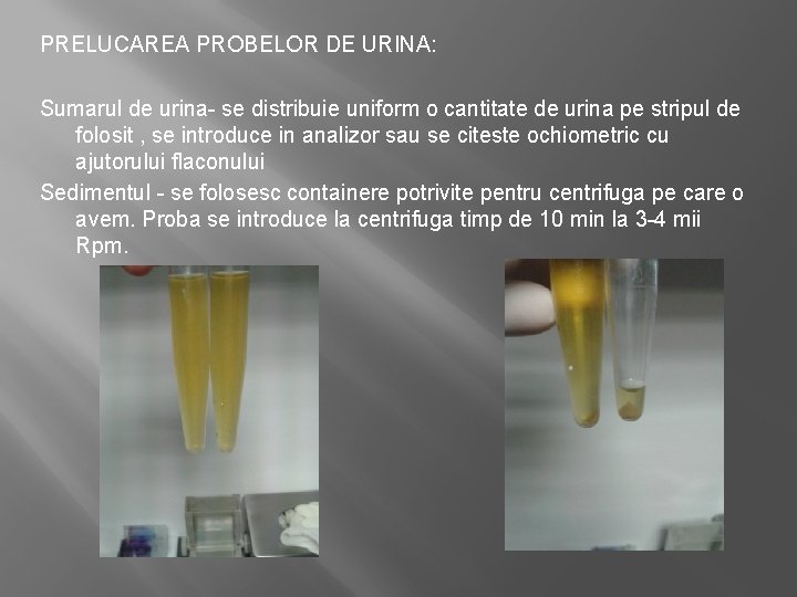 PRELUCAREA PROBELOR DE URINA: Sumarul de urina- se distribuie uniform o cantitate de urina