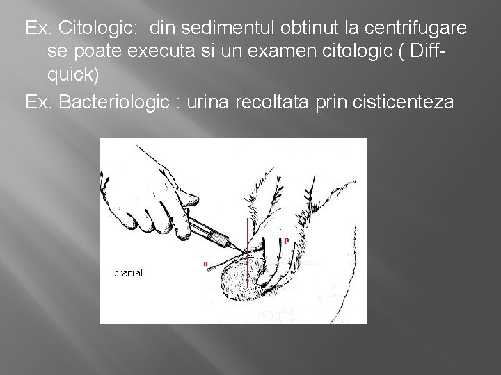 Ex. Citologic: din sedimentul obtinut la centrifugare se poate executa si un examen citologic