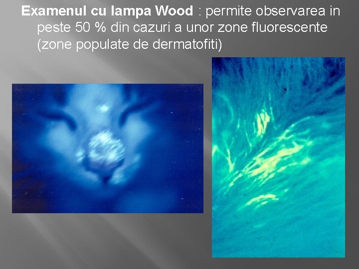 Examenul cu lampa Wood : permite observarea in peste 50 % din cazuri a