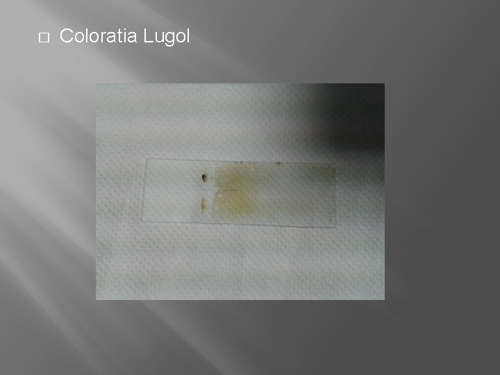 � Coloratia Lugol 