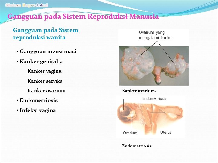 Gangguan pada Sistem Reproduksi Manusia Gangguan pada Sistem reproduksi wanita • Gangguan menstruasi •