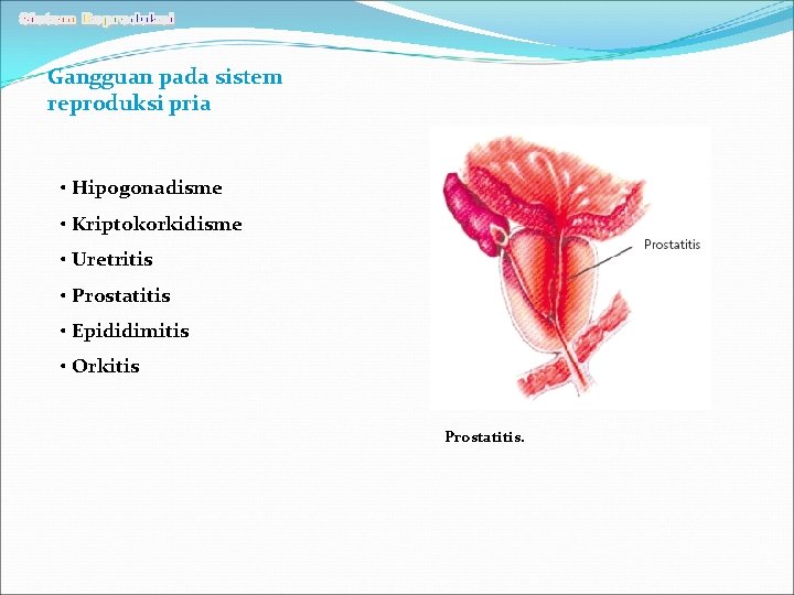 Gangguan pada sistem reproduksi pria • Hipogonadisme • Kriptokorkidisme • Uretritis • Prostatitis •