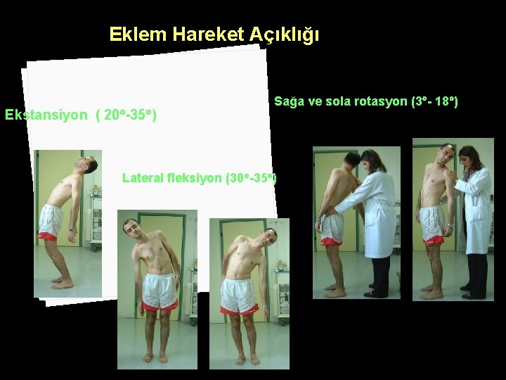 Eklem Hareket Açıklığı Ekstansiyon ( 20 -35 ) Sağa ve sola rotasyon (3 -