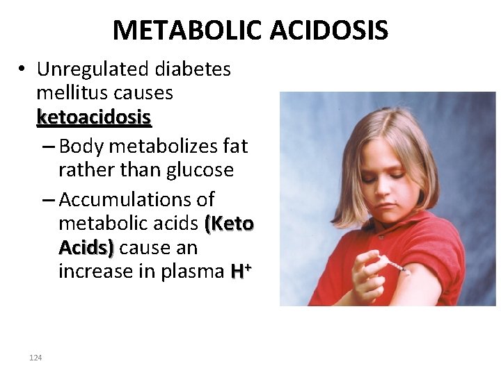 METABOLIC ACIDOSIS • Unregulated diabetes mellitus causes ketoacidosis – Body metabolizes fat rather than