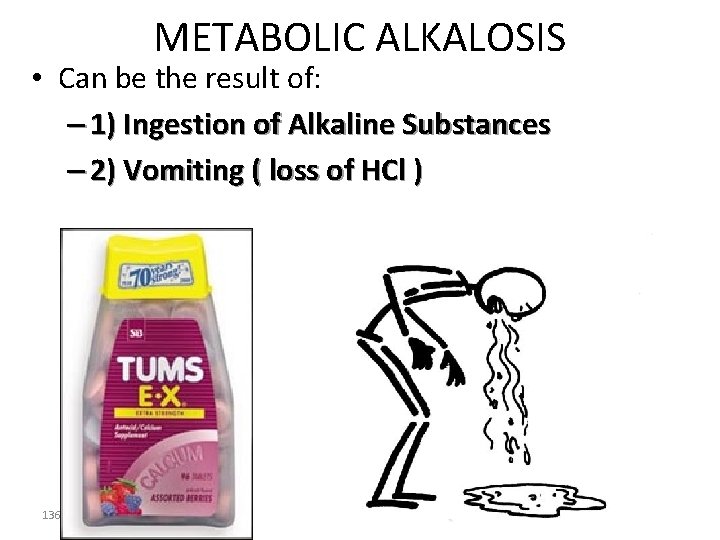 METABOLIC ALKALOSIS • Can be the result of: – 1) Ingestion of Alkaline Substances