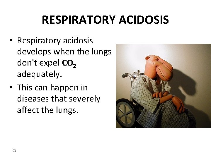 RESPIRATORY ACIDOSIS • Respiratory acidosis develops when the lungs don't expel CO 2 adequately.