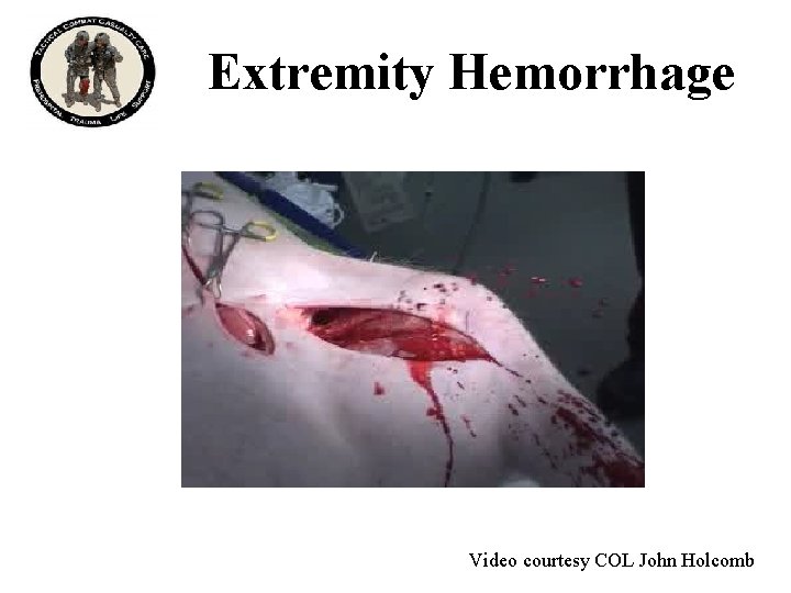 Extremity Hemorrhage Video courtesy COL John Holcomb 