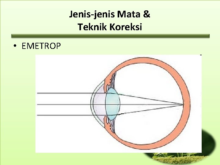 Jenis-jenis Mata & Teknik Koreksi • EMETROP 