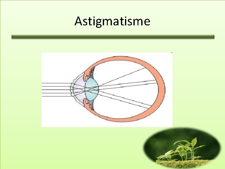 Astigmatisme 