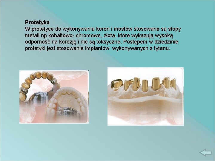 Protetyka W protetyce do wykonywania koron i mostów stosowane są stopy metali np. kobaltowo-