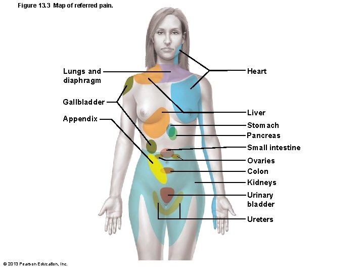 Figure 13. 3 Map of referred pain. Lungs and diaphragm Heart Gallbladder Appendix Liver