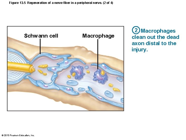 Figure 13. 5 Regeneration of a nerve fiber in a peripheral nerve. (2 of