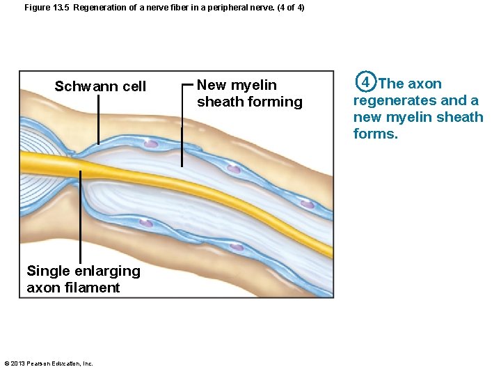 Figure 13. 5 Regeneration of a nerve fiber in a peripheral nerve. (4 of