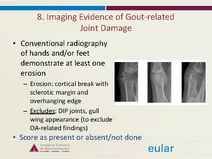 8. Imaging Evidence of Gout-related Joint Damage • Conventional radiography of hands and/or feet