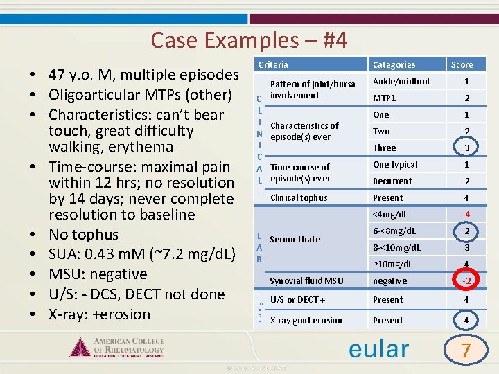 Case Examples – #4 • 47 y. o. M, multiple episodes • Oligoarticular MTPs