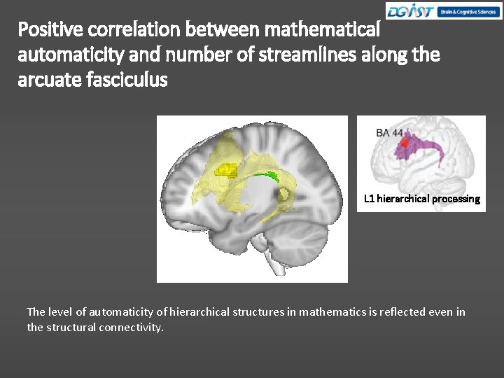 Positive correlation between mathematical automaticity and number of streamlines along the arcuate fasciculus L