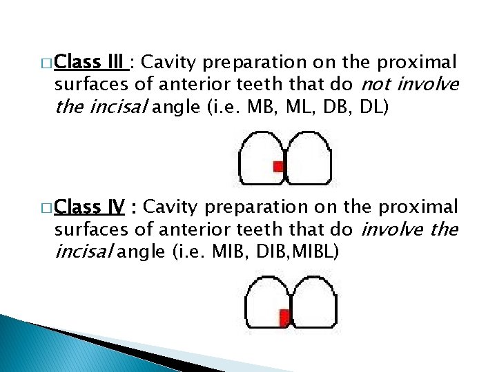 � Class III : Cavity preparation on the proximal surfaces of anterior teeth that