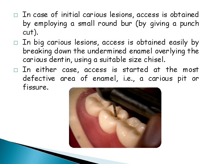 � � � In case of initial carious lesions, access is obtained by employing