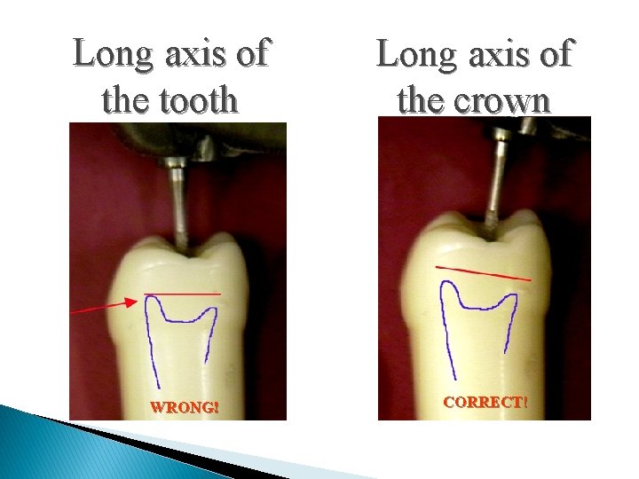 Long axis of the tooth WRONG! Long axis of the crown CORRECT! 