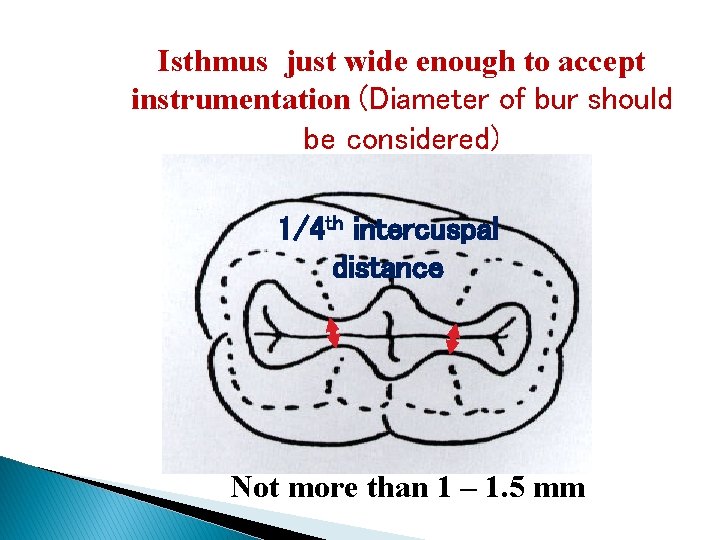 Isthmus just wide enough to accept instrumentation (Diameter of bur should be considered) 1/4