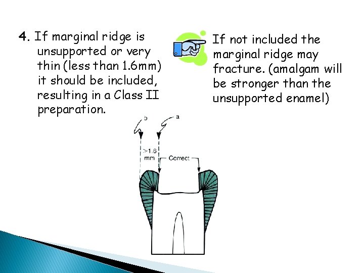 4. If marginal ridge is unsupported or very thin (less than 1. 6 mm)