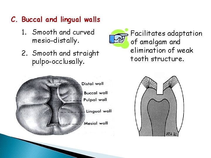 C. Buccal and lingual walls 1. Smooth and curved mesio-distally. 2. Smooth and straight